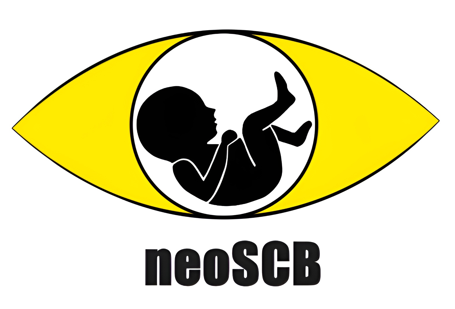 neoSCB